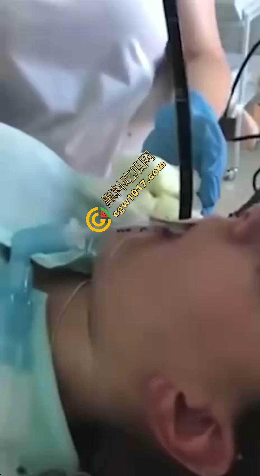 俄罗斯医院活拽1米毒蛇!女患者吞蛇卵孵化钻喉,医生手抖拽出瞬间到处乱窜! 第1张 俄罗斯医院活拽1米毒蛇!女患者吞蛇卵孵化钻喉,医生手抖拽出瞬间到处乱窜! 第1张