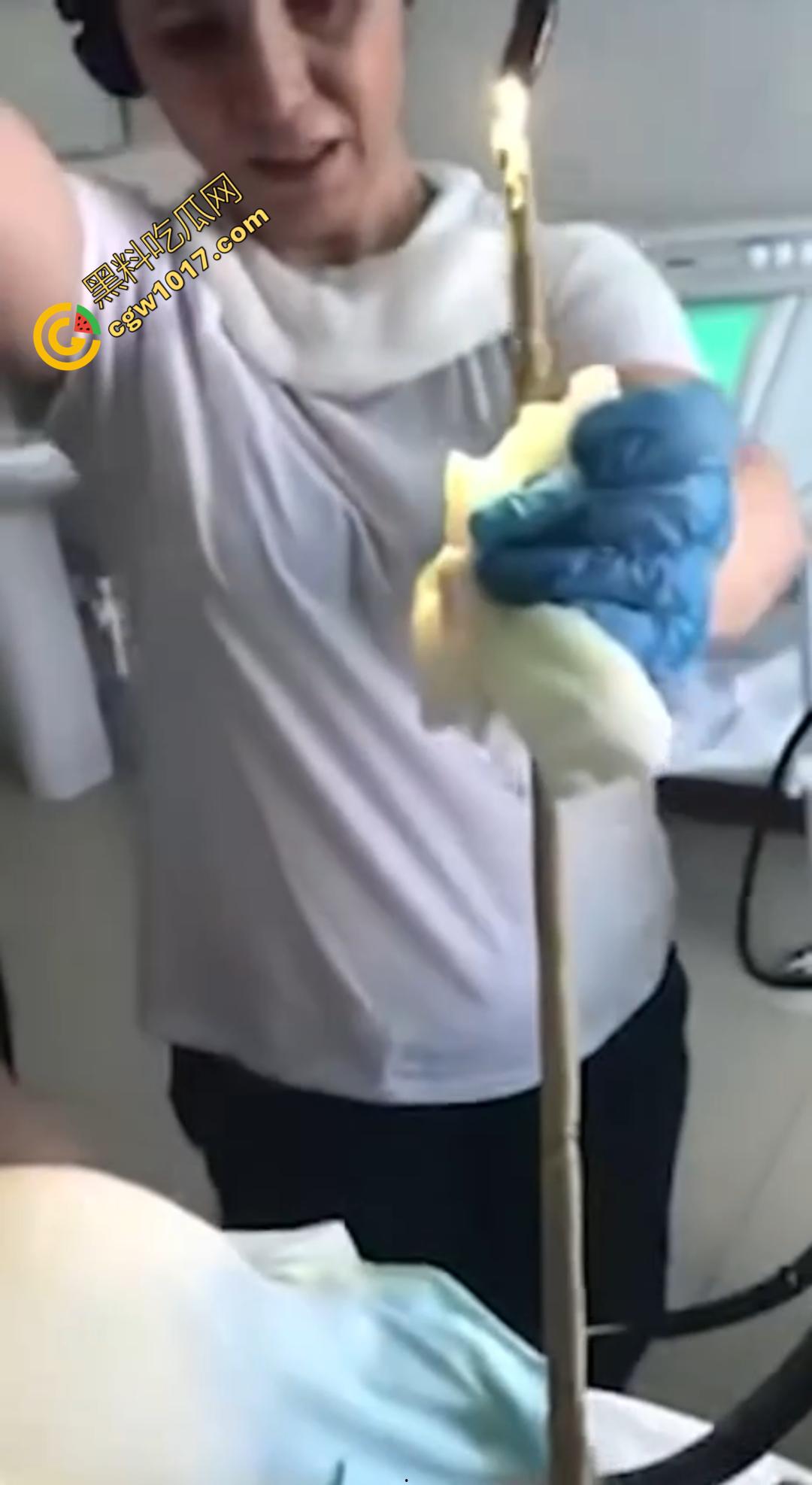 俄罗斯医院活拽1米毒蛇!女患者吞蛇卵孵化钻喉,医生手抖拽出瞬间到处乱窜! 第3张 俄罗斯医院活拽1米毒蛇!女患者吞蛇卵孵化钻喉,医生手抖拽出瞬间到处乱窜! 第3张