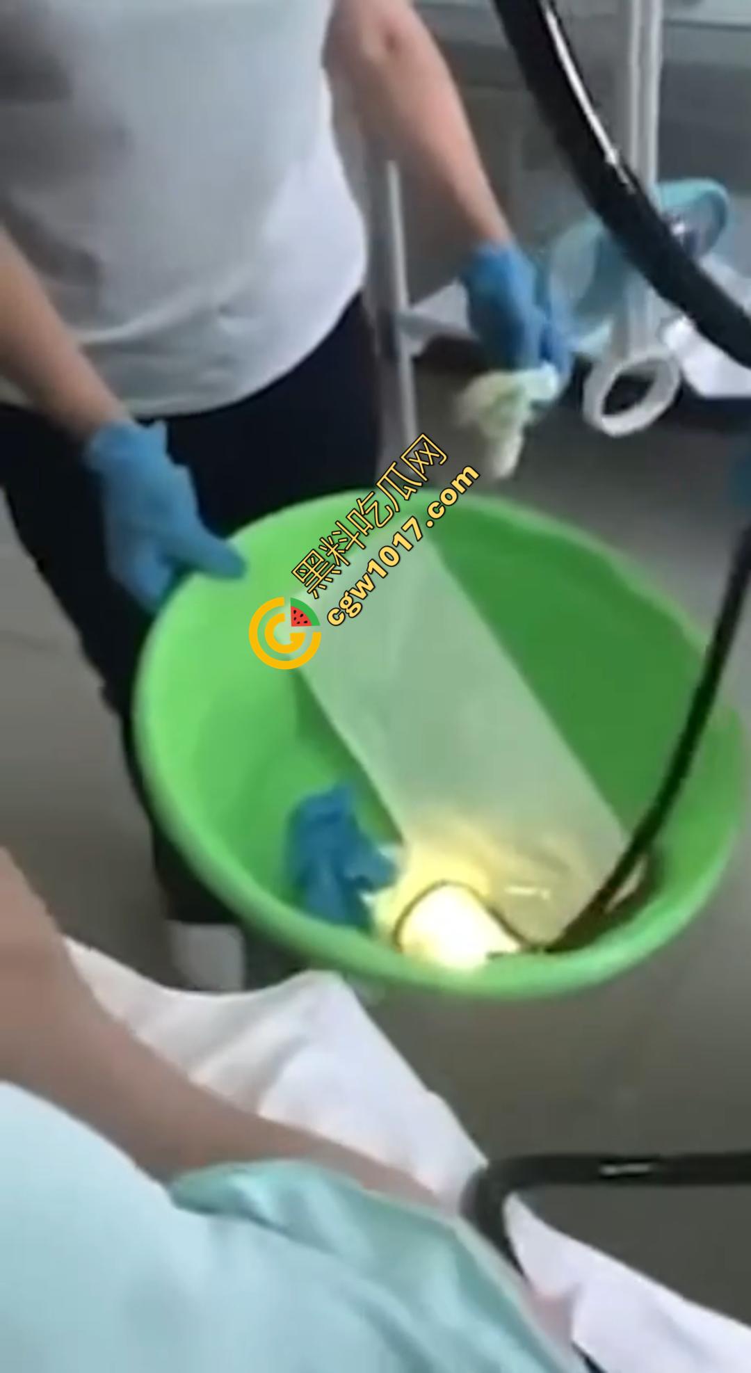 俄罗斯医院活拽1米毒蛇!女患者吞蛇卵孵化钻喉,医生手抖拽出瞬间到处乱窜! 第6张 俄罗斯医院活拽1米毒蛇!女患者吞蛇卵孵化钻喉,医生手抖拽出瞬间到处乱窜! 第6张