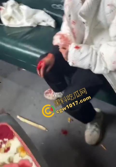 血腥慎点!社会混混残忍虐打小伙,马桶刷戳脸,铁管刺手,手背戳破血肉模糊,骨头暴露,惨不忍睹,令人心寒! 第8张 血腥慎点!社会混混残忍虐打小伙,马桶刷戳脸,铁管刺手,手背戳破血肉模糊,骨头暴露,惨不忍睹,令人心寒! 第8张