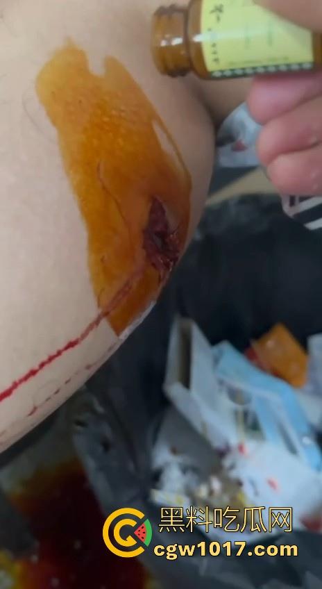 妙瓦底顺达园区缅甸KUN武装屠杀中国人!抢劫、轮奸、枪杀地盘之争,诈骗人员沦落为牺牲品,这时候你是中国人啦! 第9张 妙瓦底顺达园区缅甸KUN武装屠杀中国人!抢劫、轮奸、枪杀地盘之争,诈骗人员沦落为牺牲品,这时候你是中国人啦! 第9张