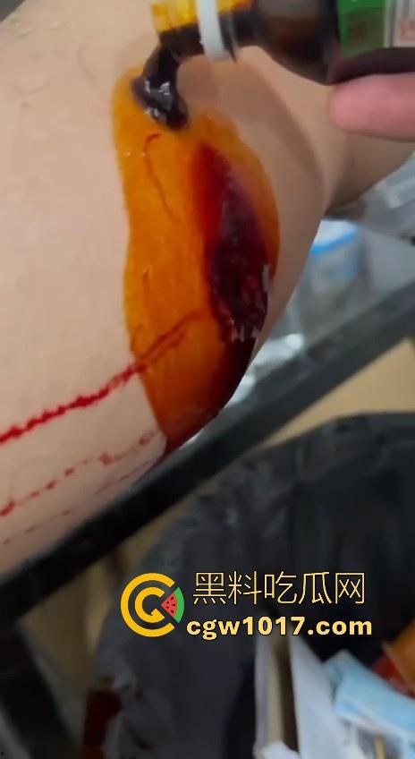 妙瓦底顺达园区缅甸KUN武装屠杀中国人!抢劫、轮奸、枪杀地盘之争,诈骗人员沦落为牺牲品,这时候你是中国人啦! 第11张 妙瓦底顺达园区缅甸KUN武装屠杀中国人!抢劫、轮奸、枪杀地盘之争,诈骗人员沦落为牺牲品,这时候你是中国人啦! 第11张