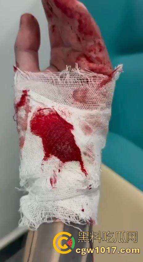 妙瓦底顺达园区缅甸KUN武装屠杀中国人!抢劫、轮奸、枪杀地盘之争,诈骗人员沦落为牺牲品,这时候你是中国人啦! 第14张 妙瓦底顺达园区缅甸KUN武装屠杀中国人!抢劫、轮奸、枪杀地盘之争,诈骗人员沦落为牺牲品,这时候你是中国人啦! 第14张