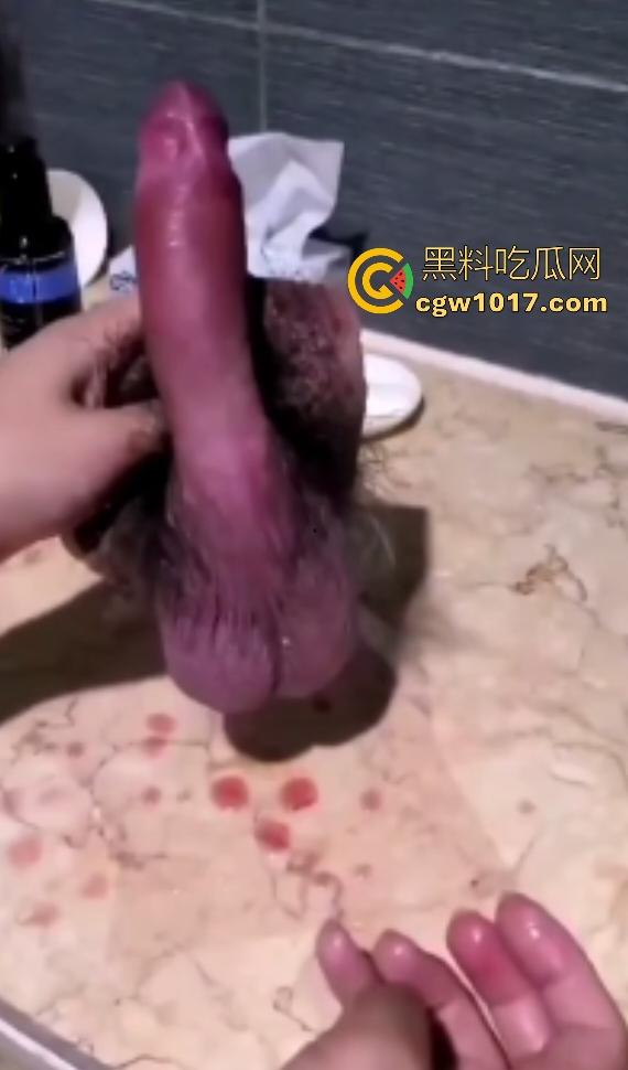 泰国自宫狂人嫌医院贵在家自割巨屌，落地后鸡巴还梆硬，后悔失去这武器，老爸见状怒吼“滚出家门”！  第5张