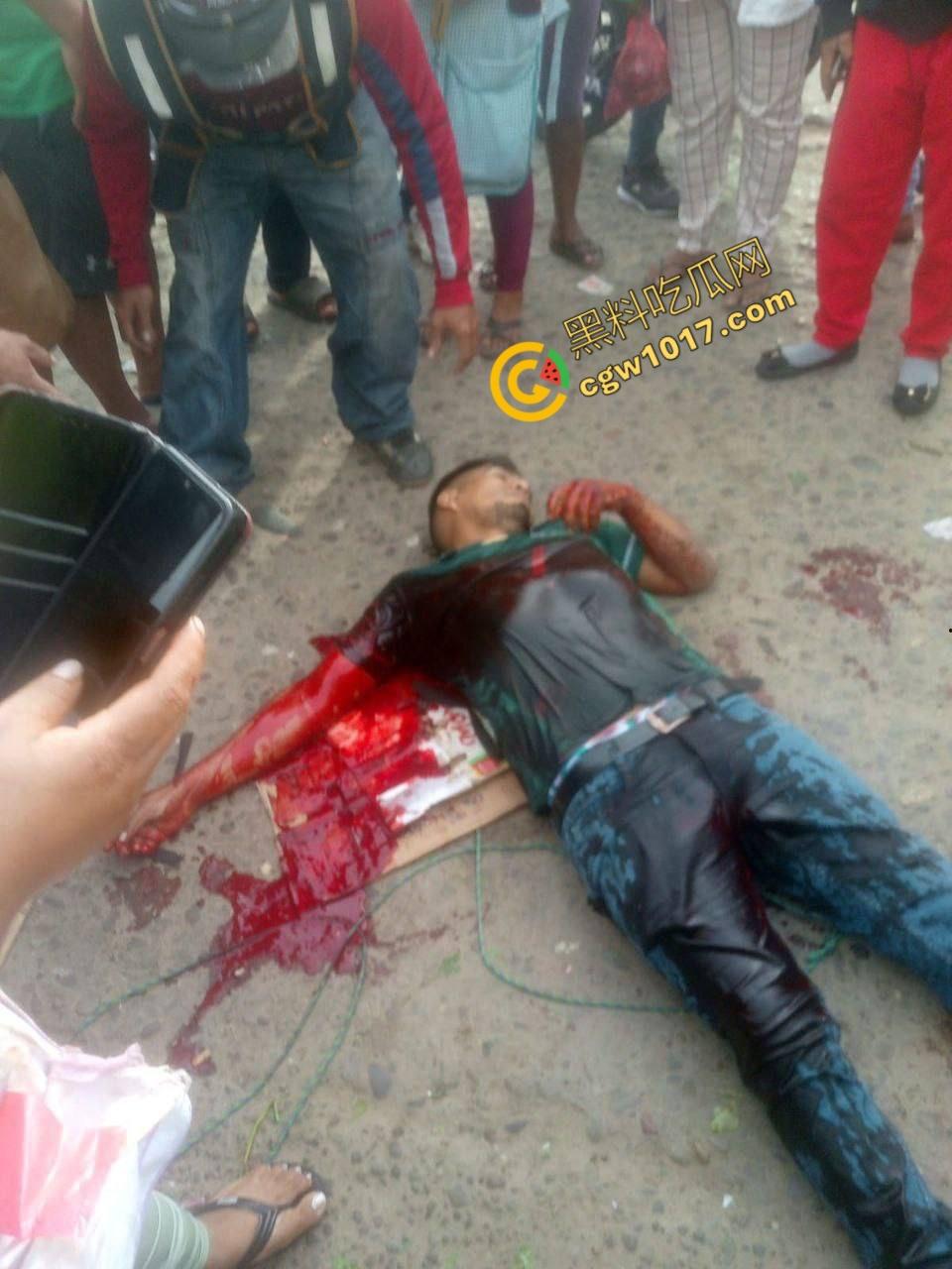 国外男子竟当街自残,刀割喉咙鲜血四溅,群众惊恐围观,男子倒地不省人事,惨烈一幕令人心悸胆战! 第10张 国外男子竟当街自残,刀割喉咙鲜血四溅,群众惊恐围观,男子倒地不省人事,惨烈一幕令人心悸胆战! 第10张