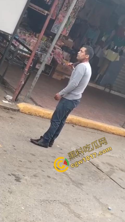 国外男子竟当街自残,刀割喉咙鲜血四溅,群众惊恐围观,男子倒地不省人事,惨烈一幕令人心悸胆战! 第6张 国外男子竟当街自残,刀割喉咙鲜血四溅,群众惊恐围观,男子倒地不省人事,惨烈一幕令人心悸胆战! 第6张