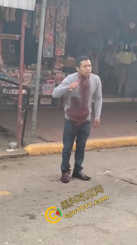 国外男子竟当街自残,刀割喉咙鲜血四溅,群众惊恐围观,男子倒地不省人事,惨烈一幕令人心悸胆战! 第8张 国外男子竟当街自残,刀割喉咙鲜血四溅,群众惊恐围观,男子倒地不省人事,惨烈一幕令人心悸胆战! 第8张