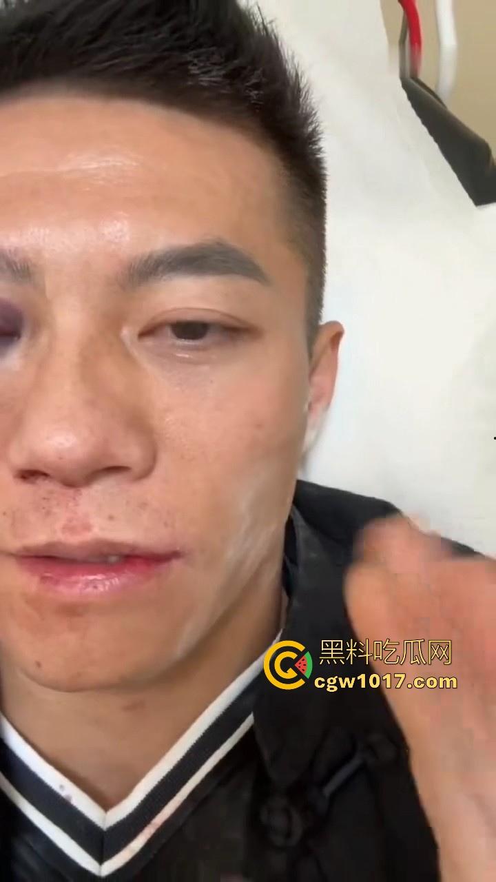 通背拳传人赵鸿刚参加UFC扇耳光大赛被对手KO！曾以为在耳光大赛上无敌的武功，没想到是这种下场，真是花拳秀腿！  第10张