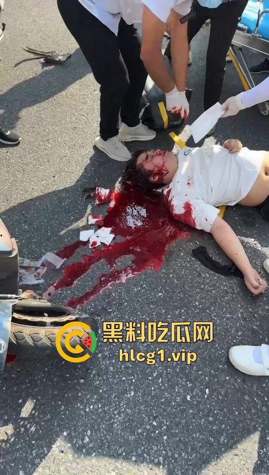 外卖小哥摩托车撞倒女子，女子头破血流浑身抽搐！  第2张