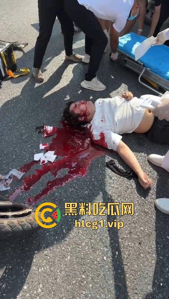 外卖小哥摩托车撞倒女子，女子头破血流浑身抽搐！  第3张