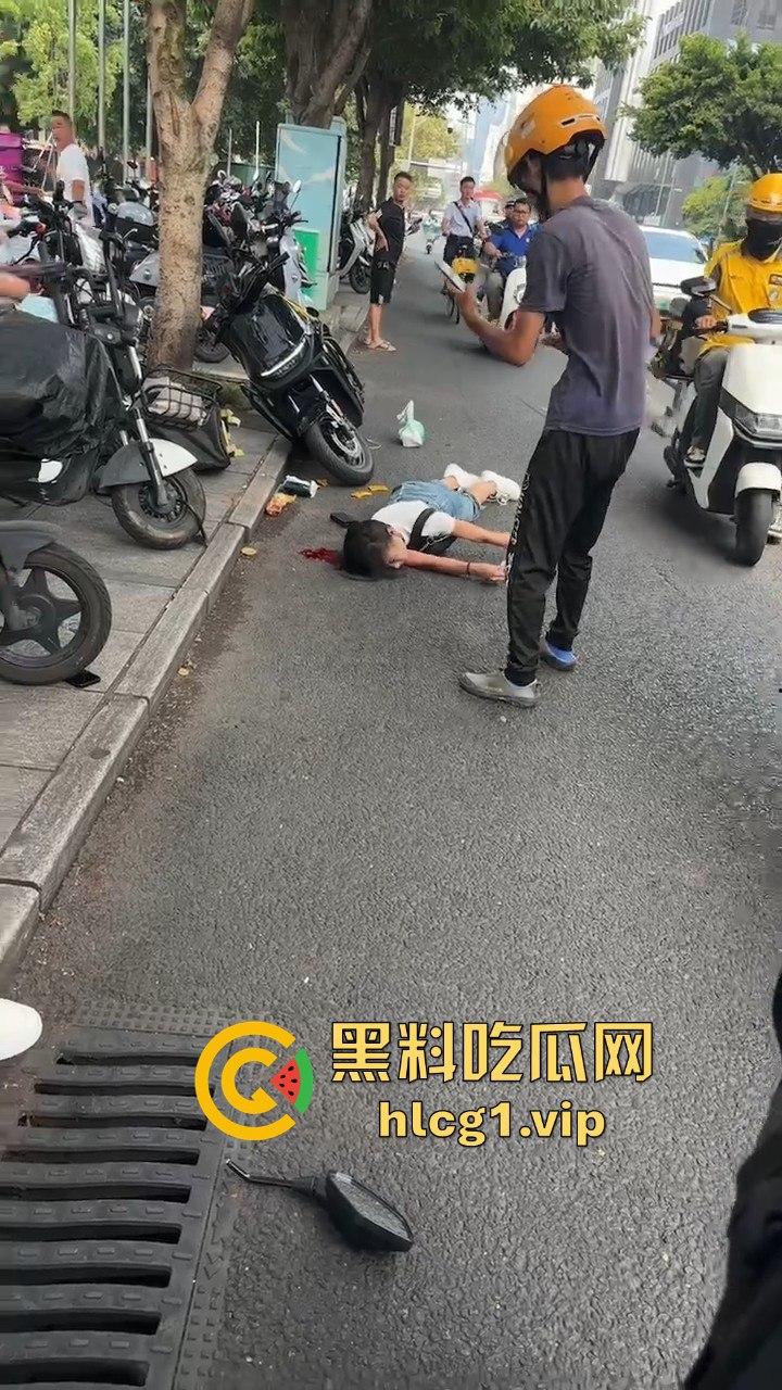 外卖小哥摩托车撞倒女子，女子头破血流浑身抽搐！  第5张