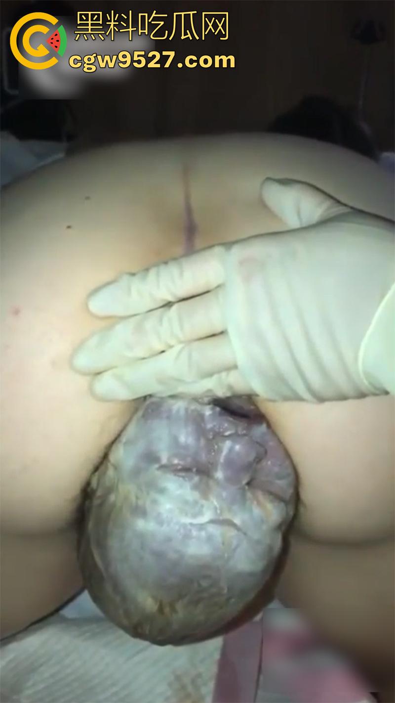 孕妇接生现场画面，体验生孩子的全过程，幸亏是个大肥逼，不然一定痛死了，原来大家都是这么来的啊！  第5张