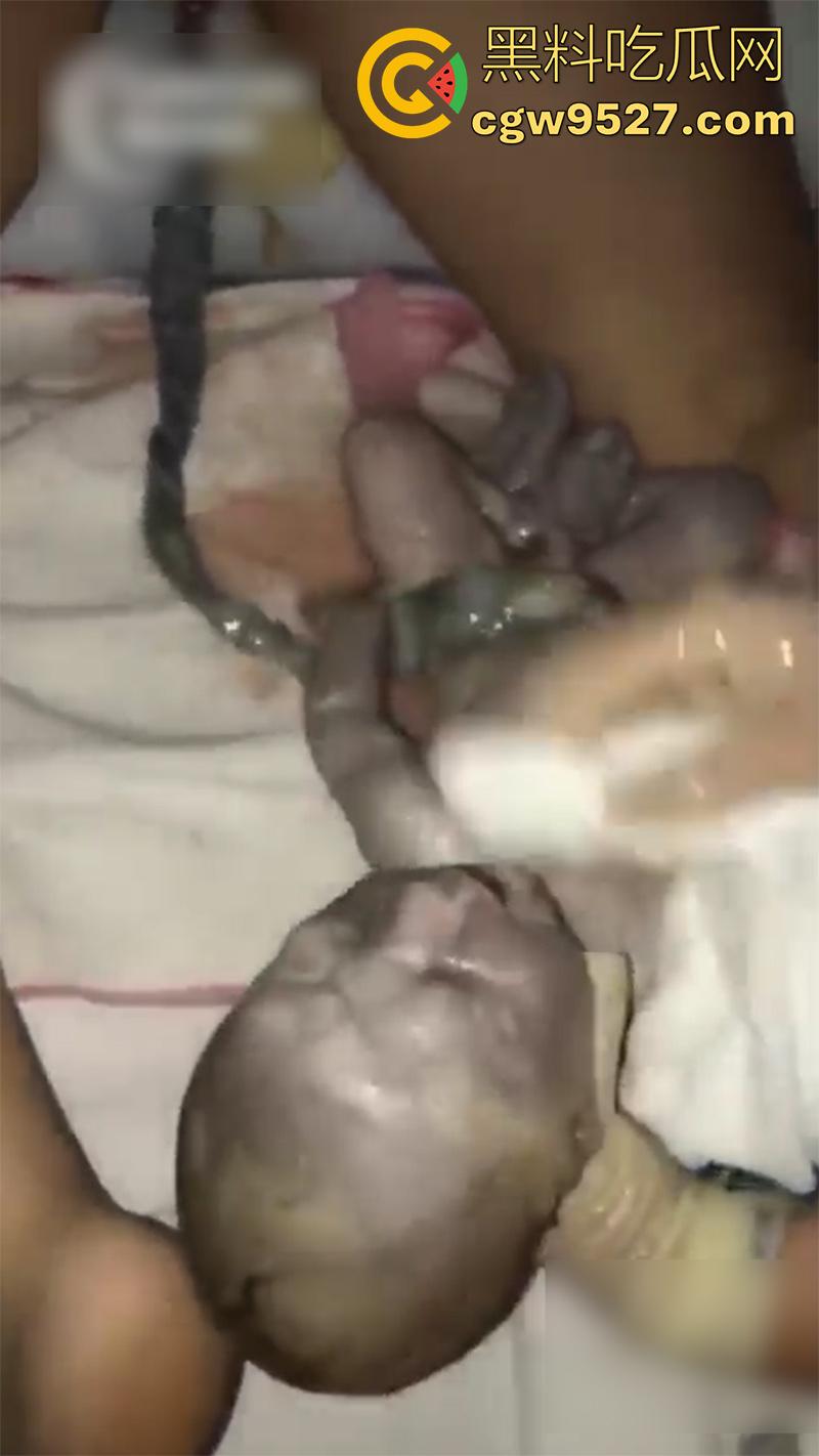 孕妇接生现场画面，体验生孩子的全过程，幸亏是个大肥逼，不然一定痛死了，原来大家都是这么来的啊！  第8张