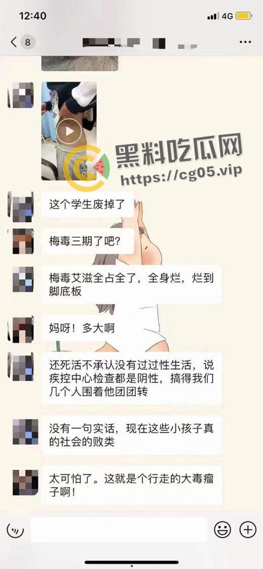 初三学生化身毒王 梅毒三期 艾滋 浑身腐烂 牛子流脓 还说自己没有过性生活 检查现场视频曝光  第5张