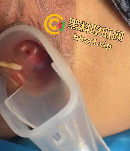 医生偷拍年轻嫩妹王雪检查全程！双腿大开取白带，清纯妹子惨遭曝光！  第7张