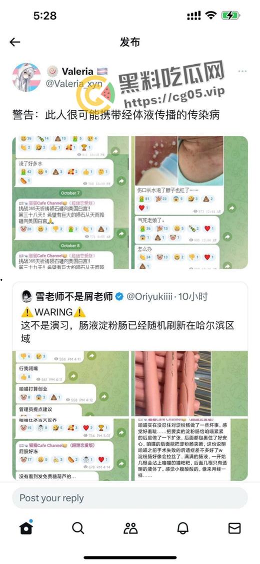 毁三观！逆天男娘在哈尔滨投毒被举报 性病晚期浑身流脓还准备卖塞进过自己直肠的烤肠创业 被热心群友举报进局子  第4张