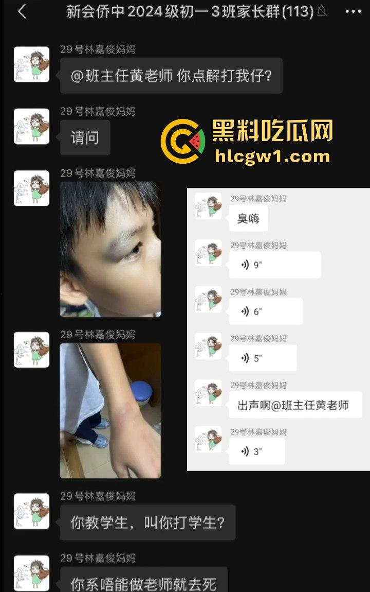 广州金隆小学曝惊天丑闻！初中学生遭体罚虐待，遍体鳞伤，家长被辱骂怒火中烧！  第8张
