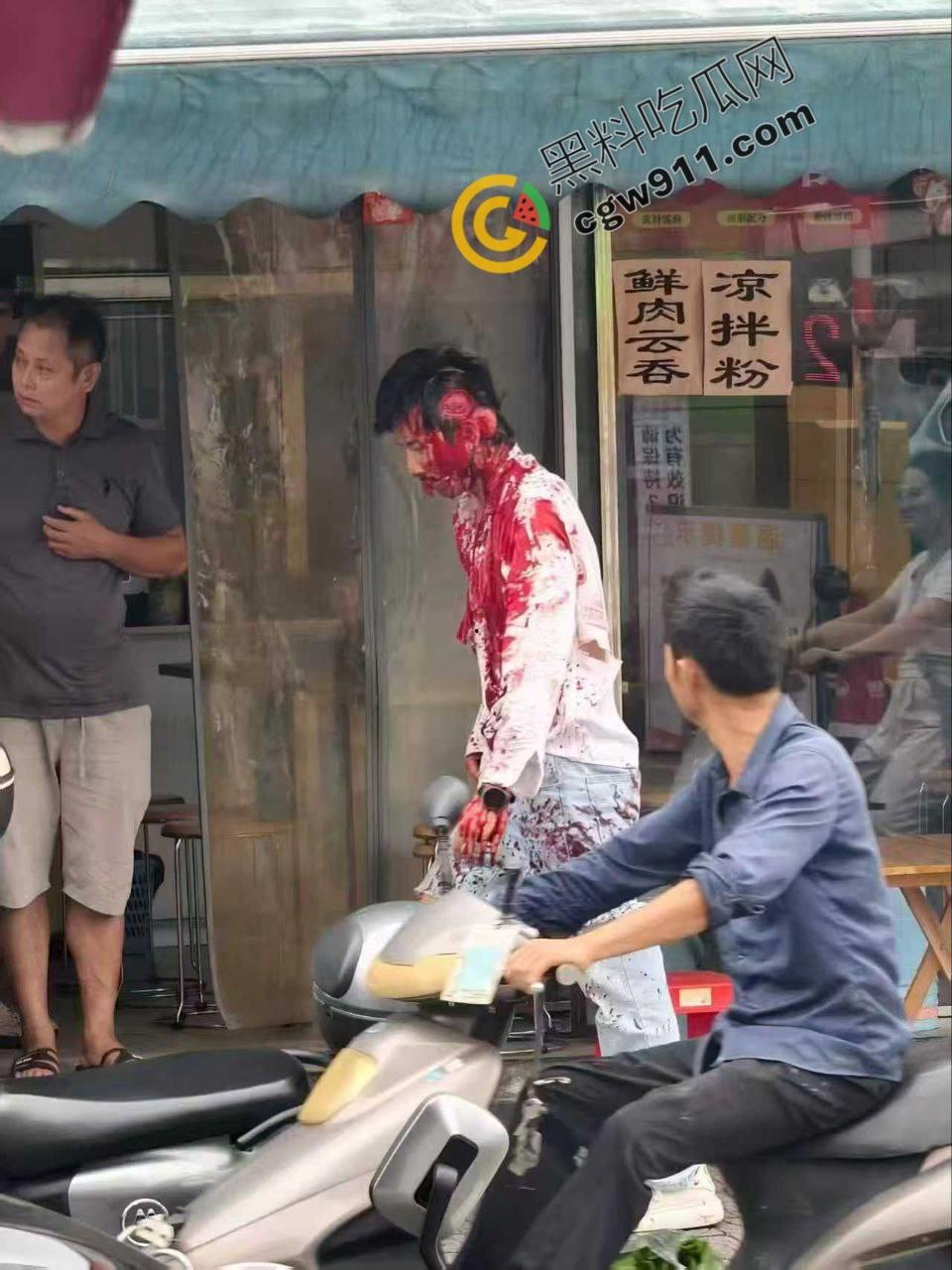 广西柳州街头疯狂砍人事件！男子疯狂持刀追砍，残暴削掉头皮，引爆全城惊恐！  第6张