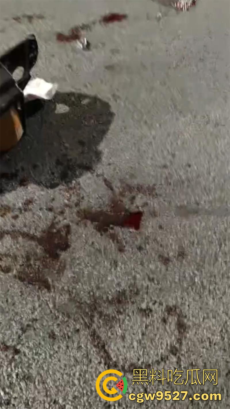 广西柳州鬼火少年，装逼失败翻车现场，自断一臂当场蒙逼，幸亏还留条命，估计再也不敢了吧！  第5张