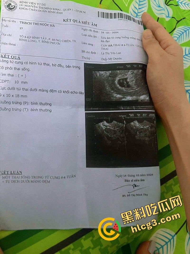 我和缅甸女友的爱情故事!这就是缅甸女的真实面孔 第1张 我和缅甸女友的爱情故事!这就是缅甸女的真实面孔 第1张