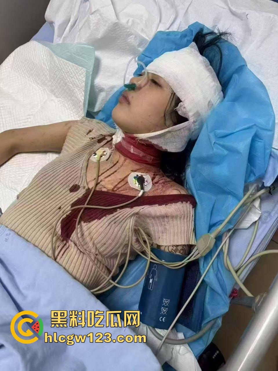 重庆精神小妹街头上演手起刀落，直接拿美工刀往脖子招呼，疯得不是一般狠！  第9张