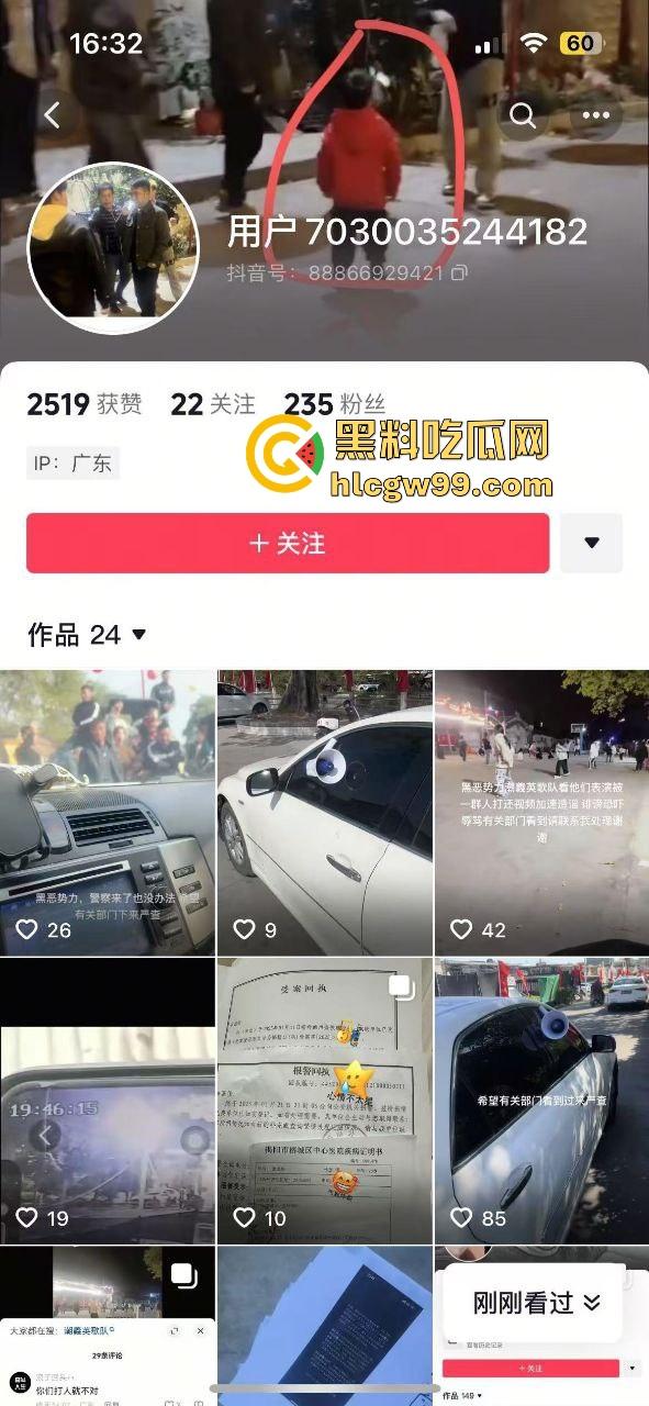 潮汕男子飙车狂言车300万撞死人保险赔,结果被英歌队打到脑震荡,现在出院嚷嚷黑势力又被围了! 第1张 潮汕男子飙车狂言车300万撞死人保险赔,结果被英歌队打到脑震荡,现在出院嚷嚷黑势力又被围了! 第1张