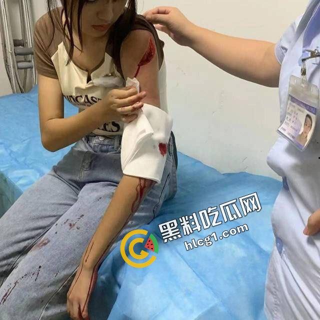 快手不知名小网红『鱼崽』街头现抓小三 提刀当街挥砍数刀 重伤小三  第6张