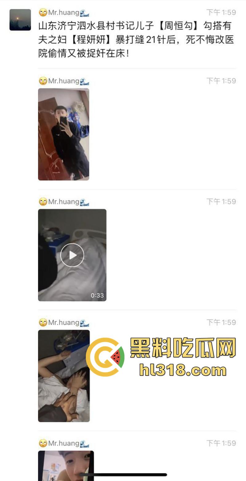 山东济宁泗水县书记儿子【周恒勾】，勾搭撩骚有夫之妇【程妍妍】，被夫家暴打缝21针，竟再次医院偷情 ！  第1张