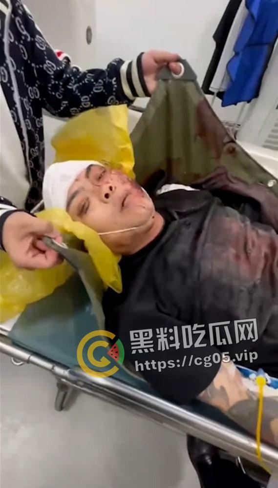 精神小伙哈尔滨斯卡拉迪厅前挑衅！上一秒嚣张至极 下一秒被打成猪头 活该  第5张