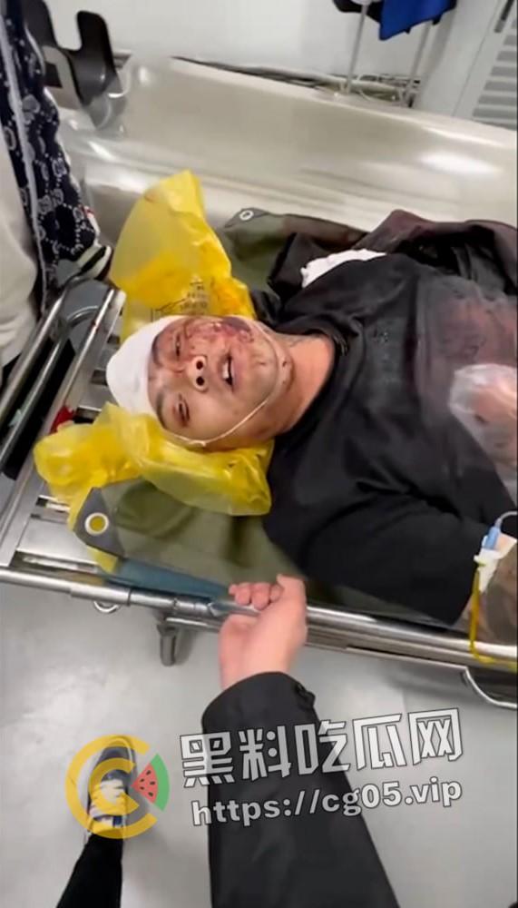 精神小伙哈尔滨斯卡拉迪厅前挑衅！上一秒嚣张至极 下一秒被打成猪头 活该  第6张