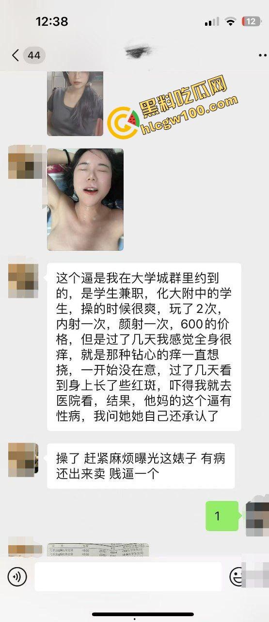 瓜友独家投稿曝光生化母体！化大附中卖淫骚鸡【余纯】600约炮单男，黑丝操逼颜射贱脸！独家流出！  第1张