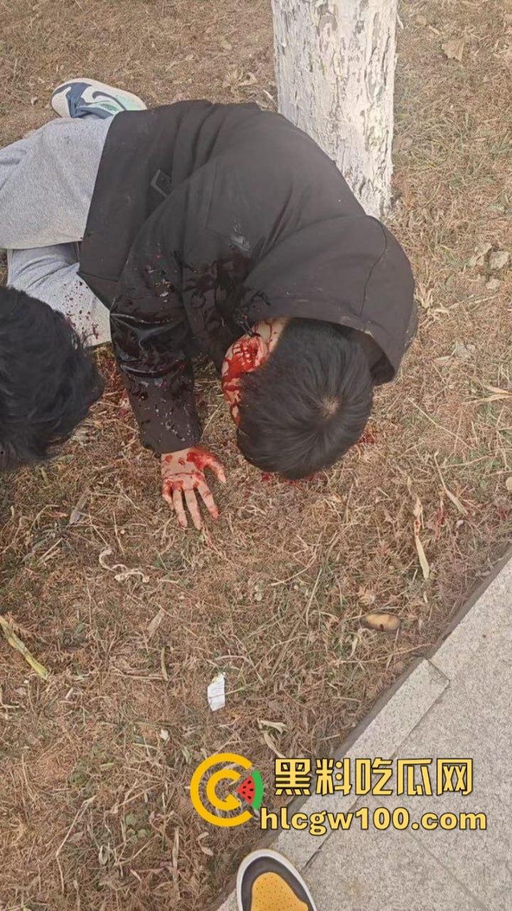 山东临沂精神小伙为抢女神交配权带兄弟持刀砍情敌 拉架小哥惨遭爆头当场脑袋开花 现场爆血视频流出！  第8张