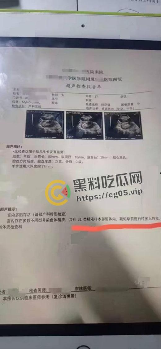 逆天大淫趴！30+男大战7女 其中不乏学生和艾滋病携带者 现场法医都给干吐了  第6张